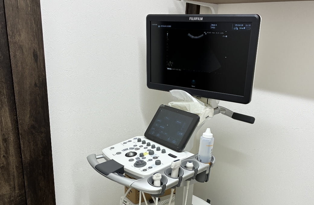エコー(超音波診断装置)の写真